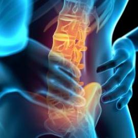 Osteochondróza: běžné příčiny a léčba